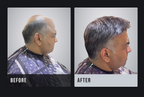 Men Patches | 100% Human Hair