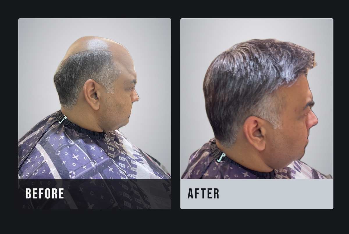 Men Patches | 100% Human Hair